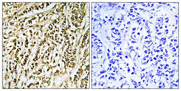 FEN-1 Rabbit Polyclonal Antibody | 兔多抗 | EnkiLife恩玑生命