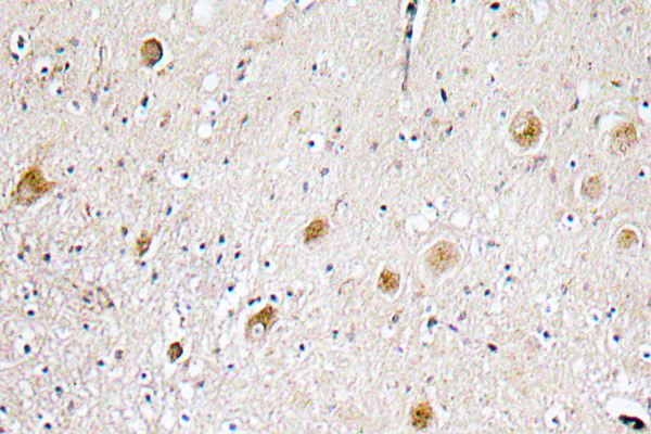 FGF-1 Rabbit Polyclonal Antibody | 兔多抗 | EnkiLife恩玑生命