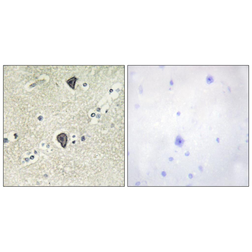 FGFR-3 Rabbit Polyclonal Antibody | 兔多抗 | EnkiLife恩玑生命