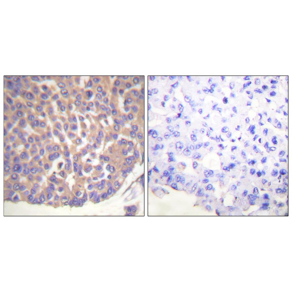 Filamin 1 Rabbit Polyclonal Antibody | 兔多抗 | EnkiLife恩玑生命