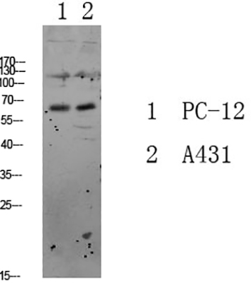 FKHRL1 Rabbit Polyclonal Antibody | 兔多抗 | EnkiLife恩玑生命