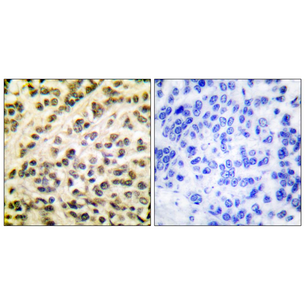 Fli-1 Rabbit Polyclonal Antibody | 兔多抗 | EnkiLife恩玑生命
