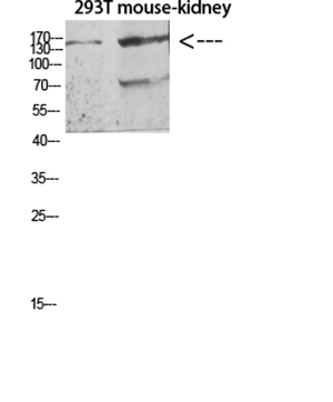 Flt-4 Rabbit Polyclonal Antibody | 兔多抗 | EnkiLife恩玑生命