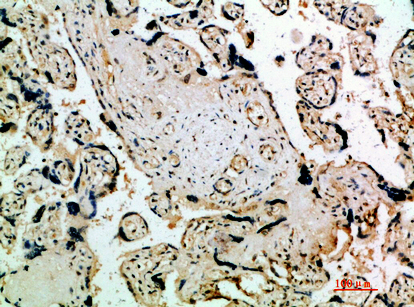 Flt-4 Rabbit Polyclonal Antibody | 兔多抗 | EnkiLife恩玑生命