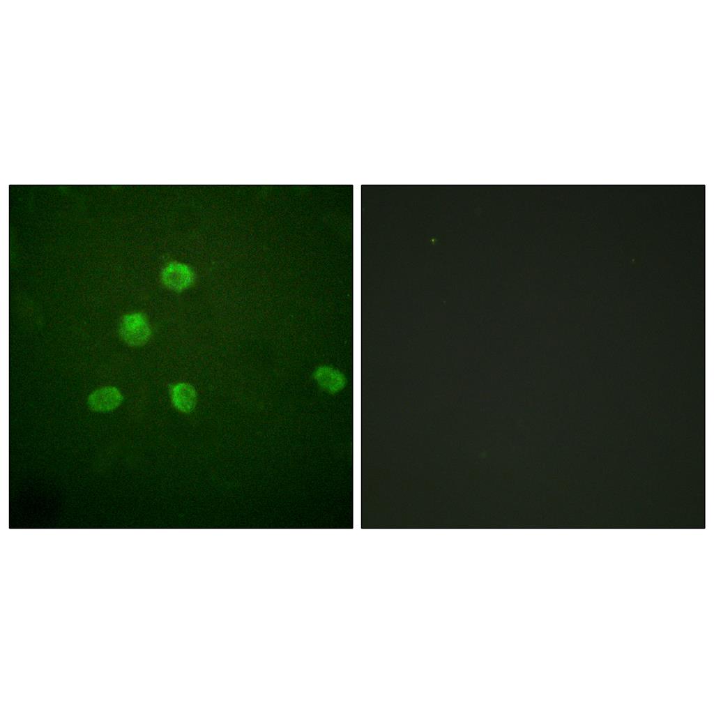Fos B Rabbit Polyclonal Antibody | 兔多抗 | EnkiLife恩玑生命