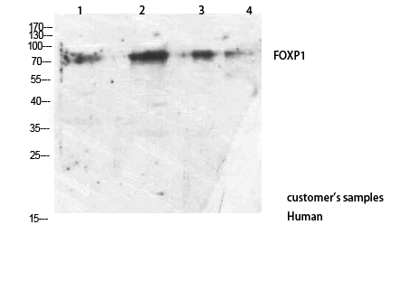 FOXP1 Rabbit Polyclonal Antibody | 兔多抗 | EnkiLife恩玑生命