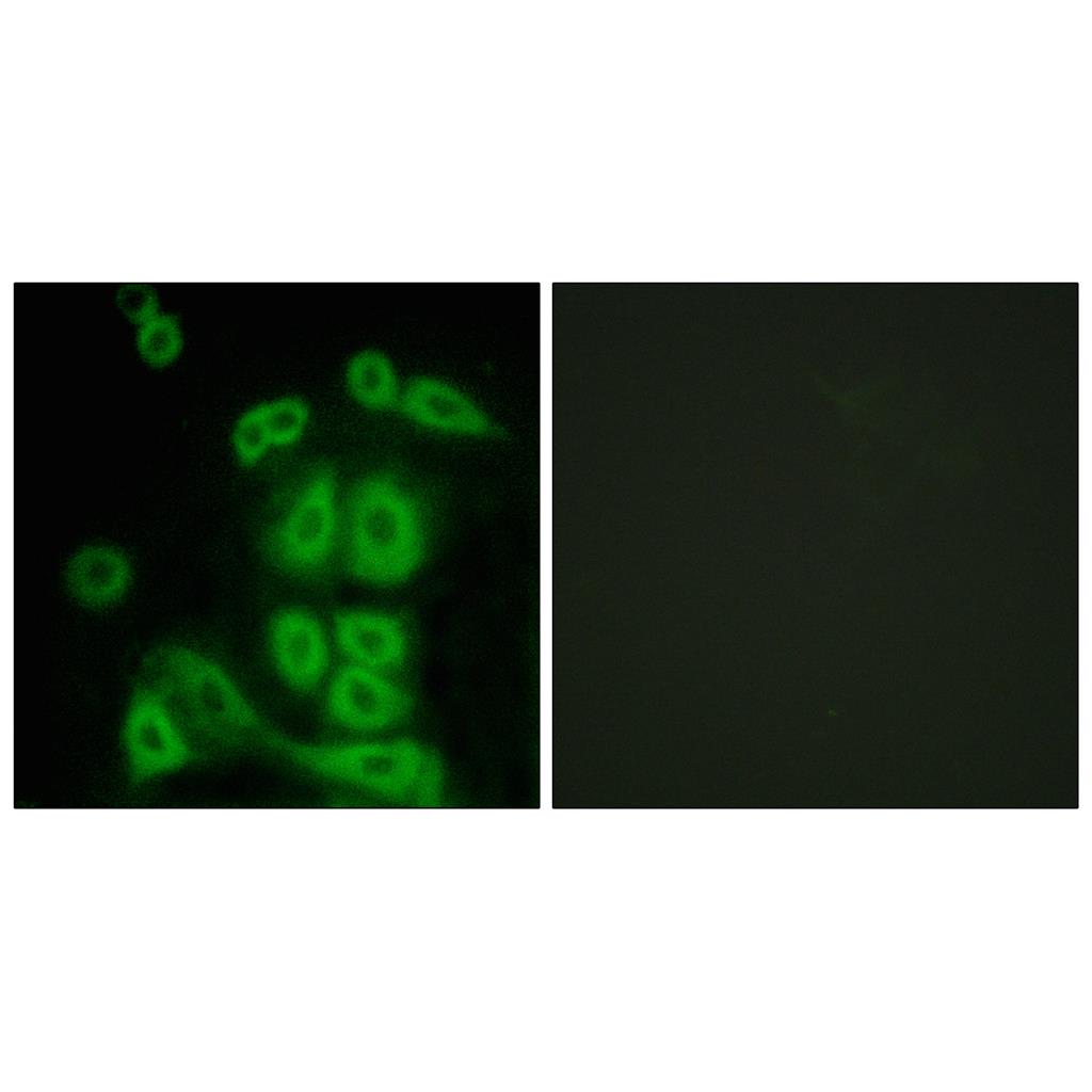 FXR2 Rabbit Polyclonal Antibody | 兔多抗 | EnkiLife恩玑生命