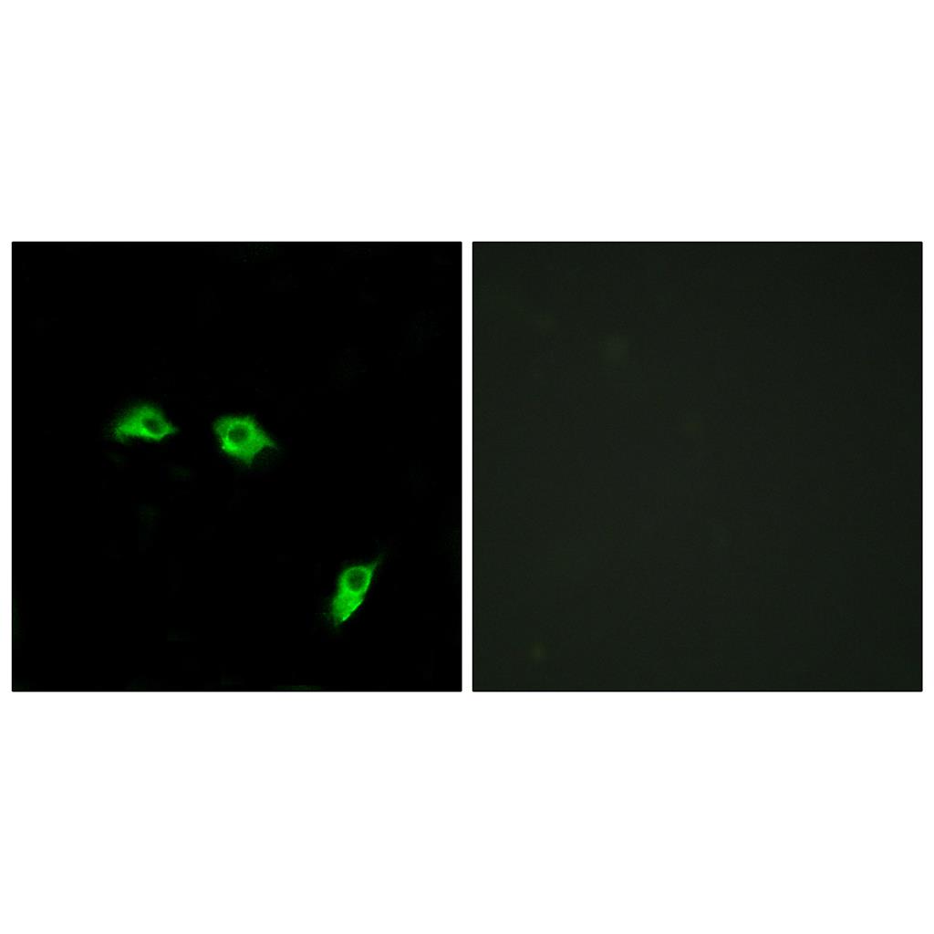 GABAB R1 Rabbit Polyclonal Antibody | 兔多抗 | EnkiLife恩玑生命