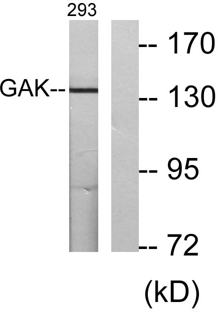 GAK Rabbit Polyclonal Antibody | 兔多抗 | EnkiLife恩玑生命