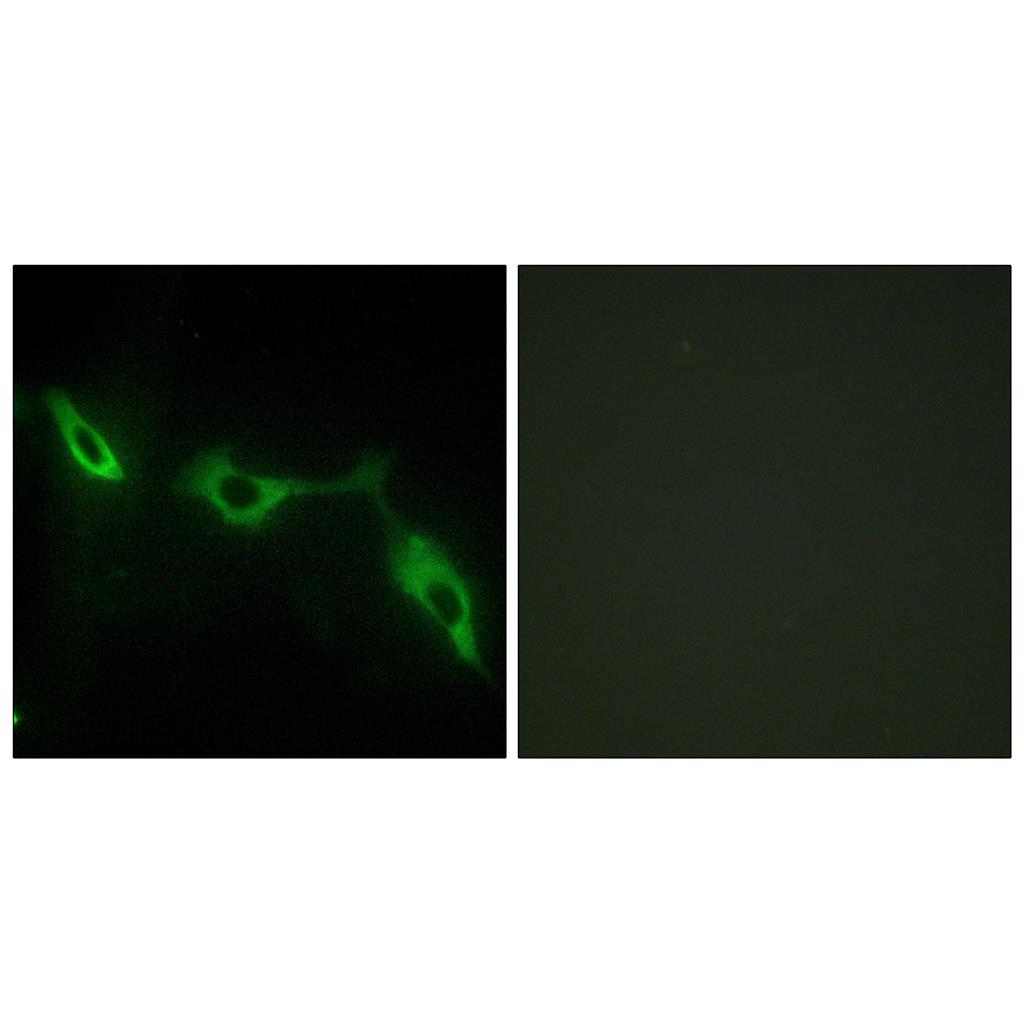 Galectin-9 Rabbit Polyclonal Antibody | 兔多抗 | EnkiLife恩玑生命