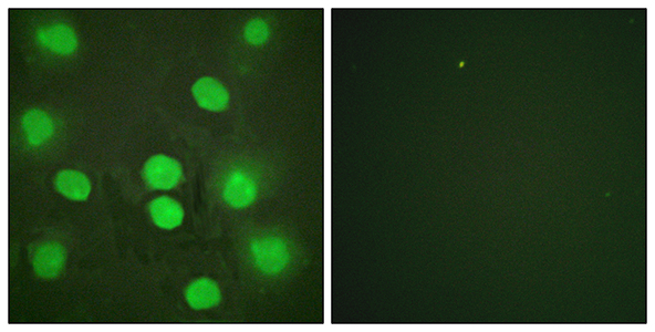 GATA-4 Rabbit Polyclonal Antibody | 兔多抗 | EnkiLife恩玑生命