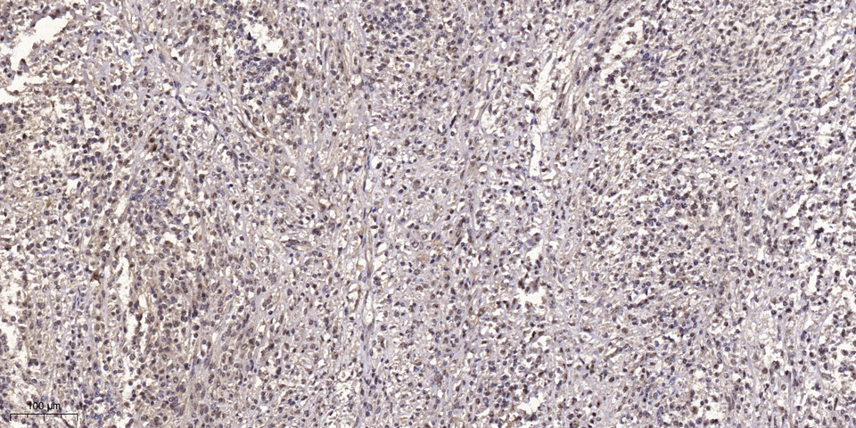 GBP5 Rabbit Polyclonal Antibody | 兔多抗 | EnkiLife恩玑生命