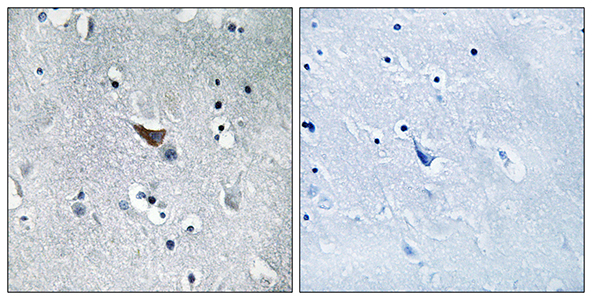 GluR-1 Rabbit Polyclonal Antibody | 兔多抗 | EnkiLife恩玑生命
