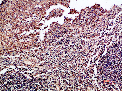 GM-CSF Rabbit Polyclonal Antibody | 兔多抗 | EnkiLife恩玑生命