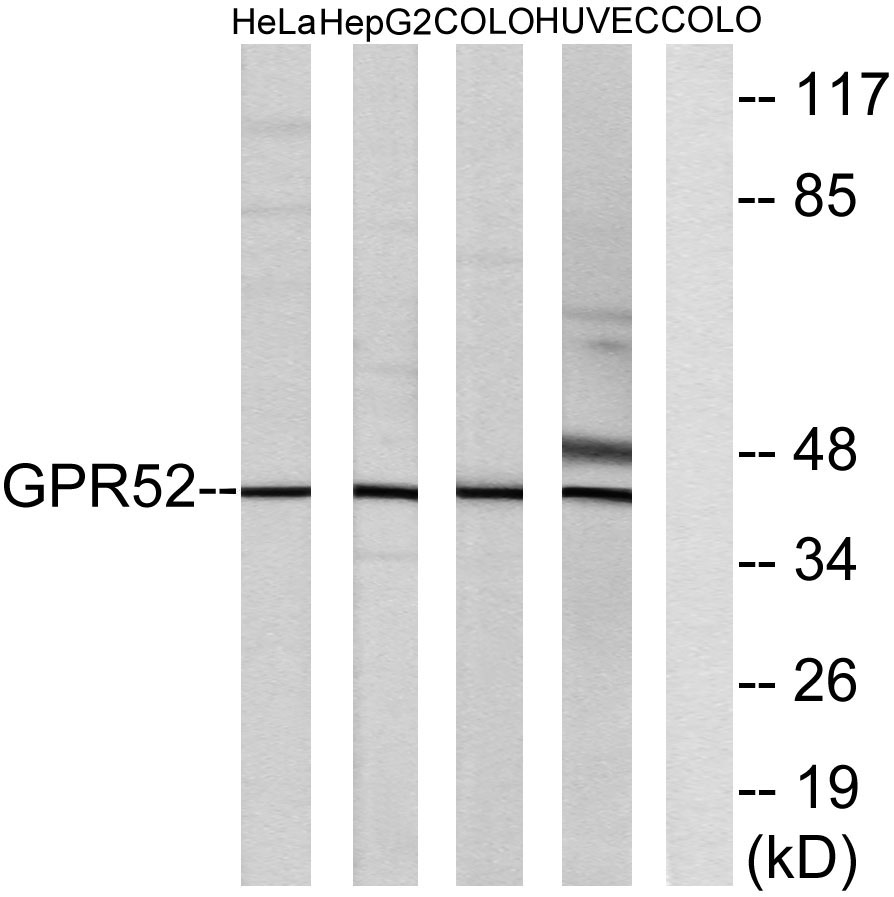 GPR52 Rabbit Polyclonal Antibody | 兔多抗 | EnkiLife恩玑生命