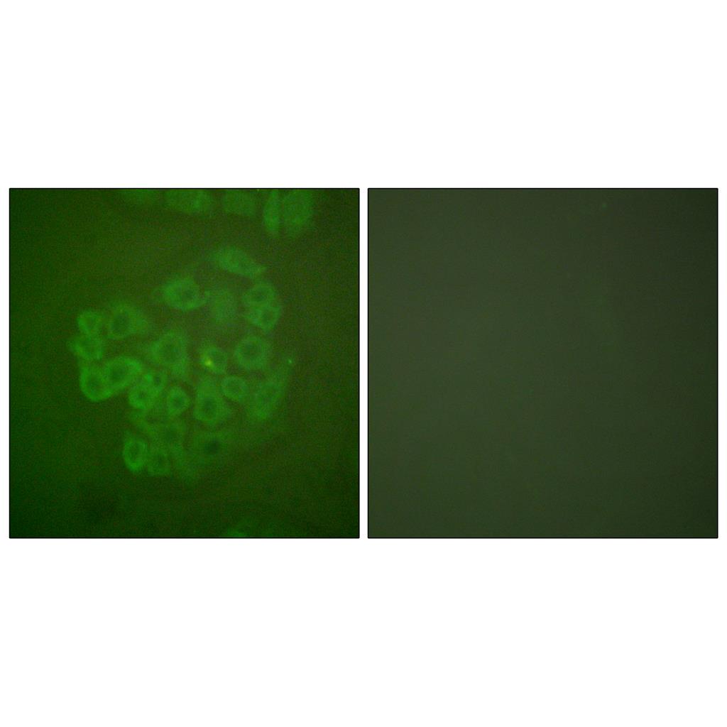 GR Rabbit Polyclonal Antibody | 兔多抗 | EnkiLife恩玑生命