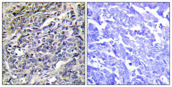 Granzyme K Rabbit Polyclonal Antibody | 兔多抗 | EnkiLife恩玑生命