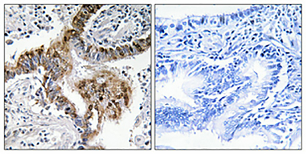 GRK 2 Rabbit Polyclonal Antibody | 兔多抗 | EnkiLife恩玑生命