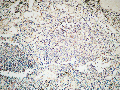 GTBP Rabbit Polyclonal Antibody | 兔多抗 | EnkiLife恩玑生命