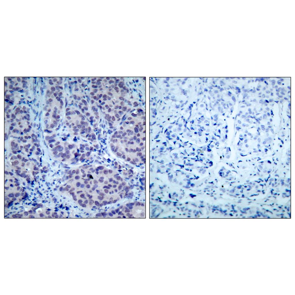 HDAC2 Rabbit Polyclonal Antibody | 兔多抗 | EnkiLife恩玑生命