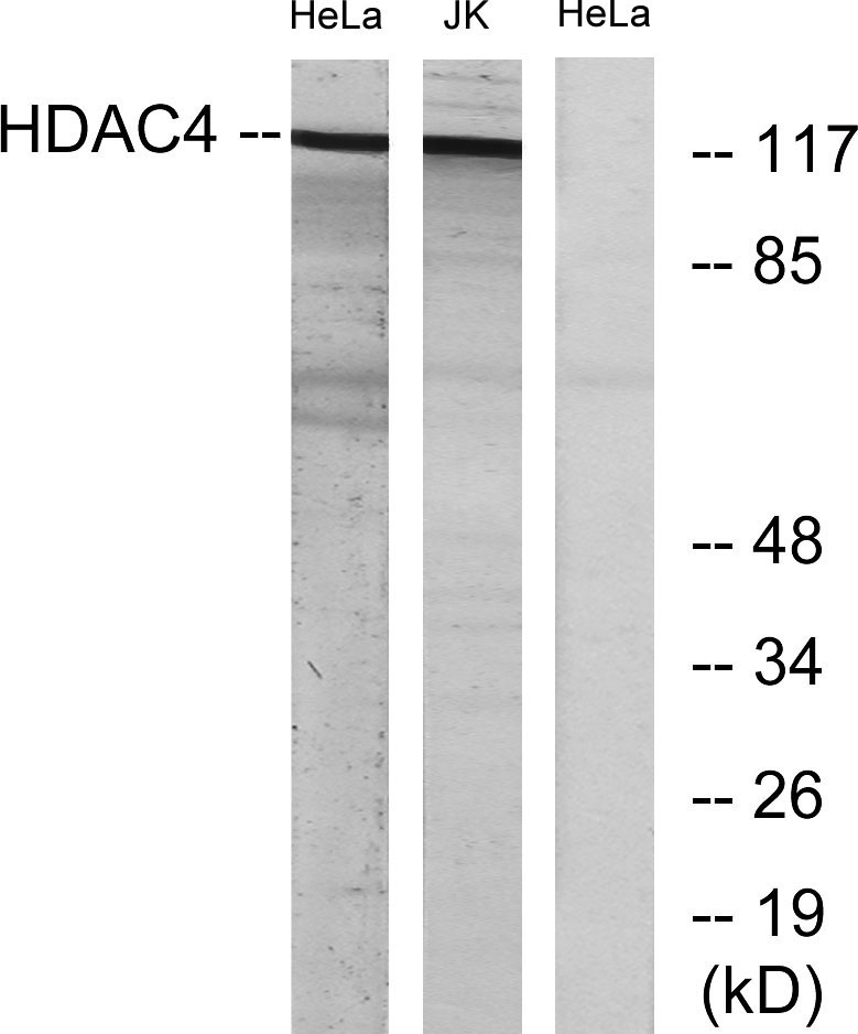 HDAC4 Rabbit Polyclonal Antibody | 兔多抗 | EnkiLife恩玑生命
