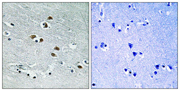 HDAC6 Rabbit Polyclonal Antibody | 兔多抗 | EnkiLife恩玑生命