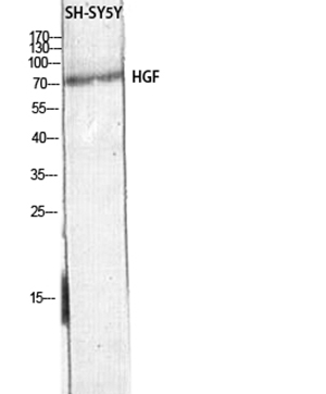HGF Rabbit Polyclonal Antibody | 兔多抗 | EnkiLife恩玑生命