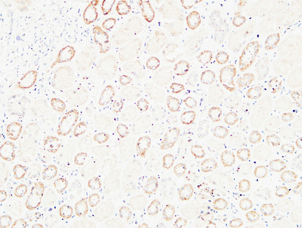 HGF Rabbit Polyclonal Antibody | 兔多抗 | EnkiLife恩玑生命