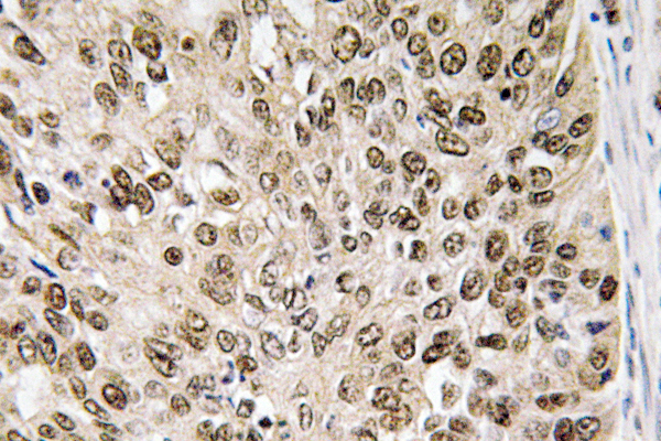 HIF-1α Rabbit Polyclonal Antibody | 兔多抗 | EnkiLife恩玑生命