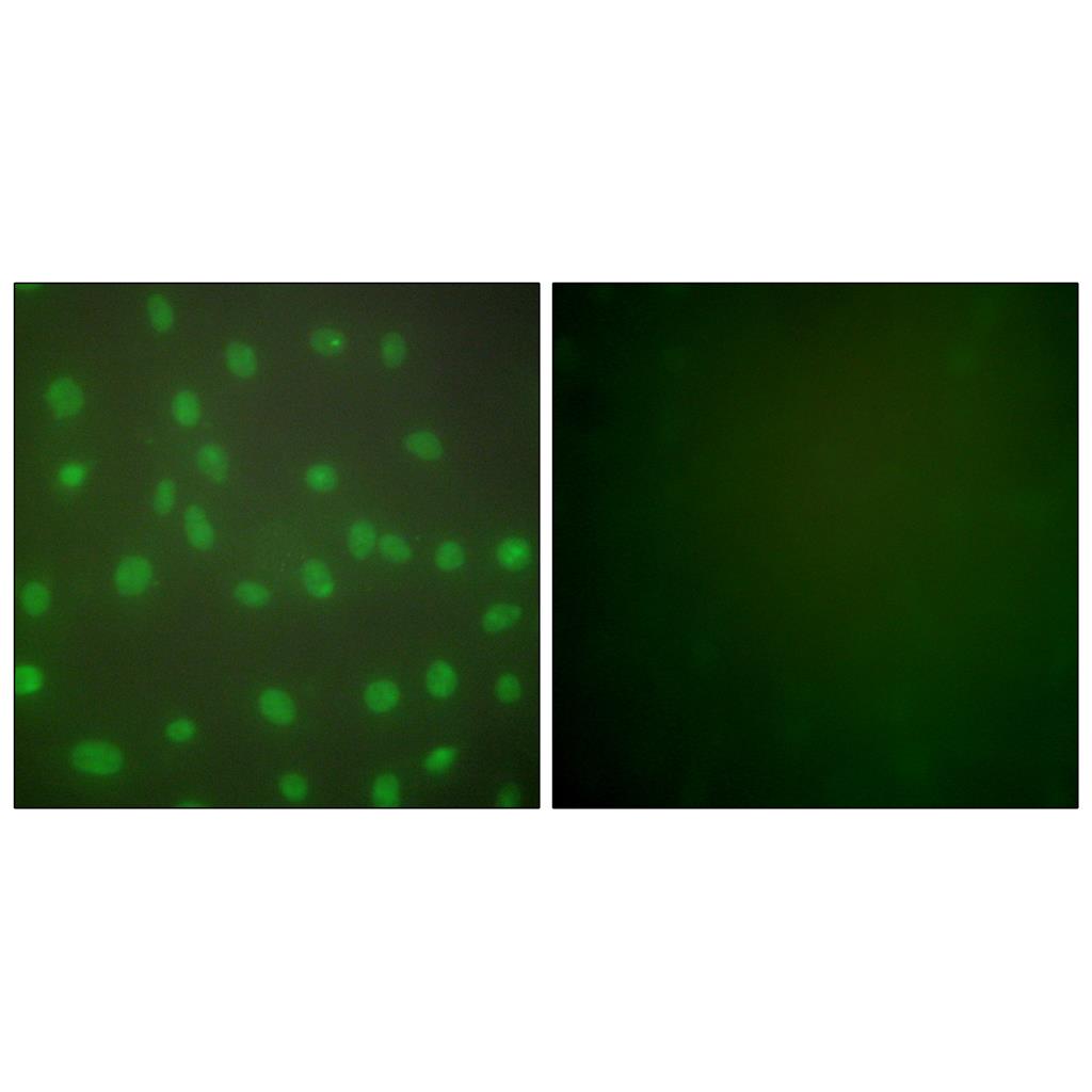 Histone deacetylase 1 Rabbit Polyclonal Antibody | 兔多抗 | EnkiLife恩玑生命