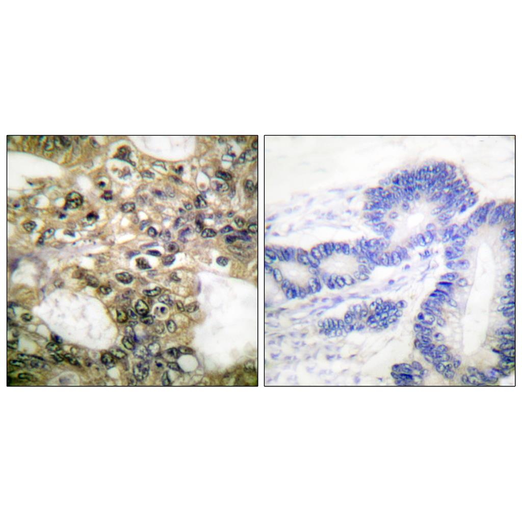 Histone deacetylase 6 Rabbit Polyclonal Antibody | 兔多抗 | EnkiLife恩玑生命