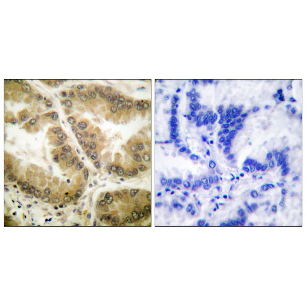 Histone deacetylase 7a Rabbit Polyclonal Antibody | 兔多抗 | EnkiLife恩玑生命