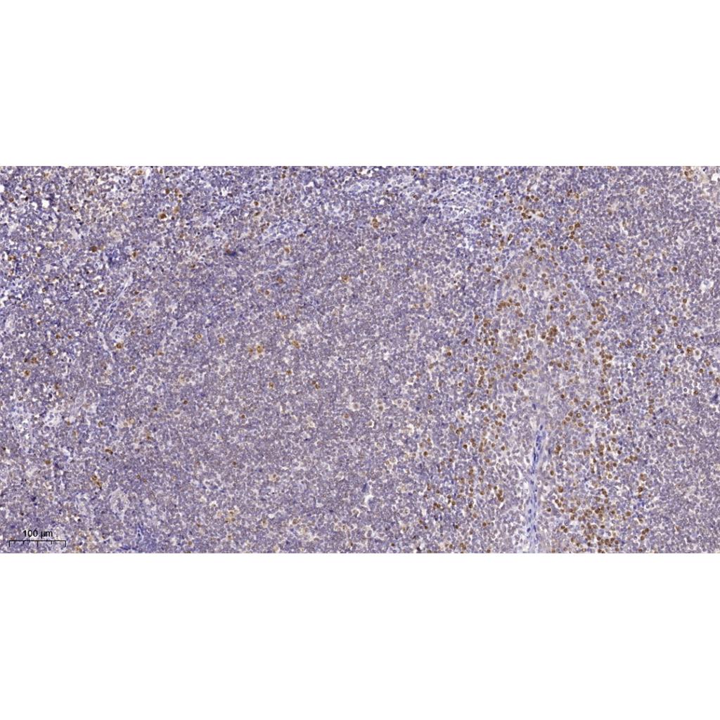 HMG-I/HMG-Y  Rabbit Polyclonal Antibody | 兔多抗 | EnkiLife恩玑生命