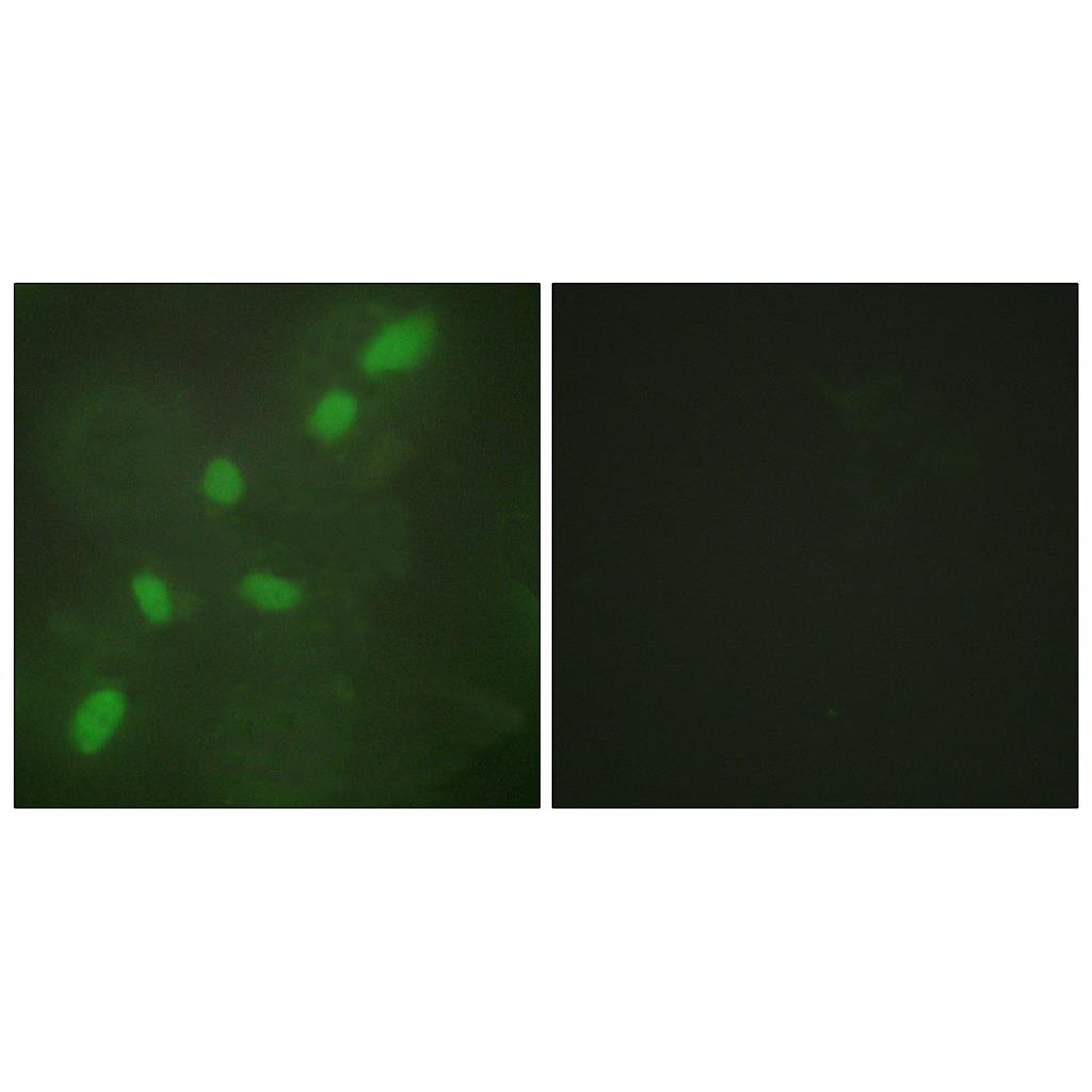 hnRNP A2/B1 Rabbit Polyclonal Antibody | 兔多抗 | EnkiLife恩玑生命