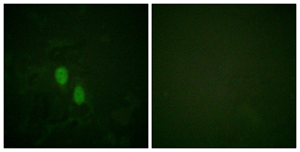 hnRNP D0 Rabbit Polyclonal Antibody | 兔多抗 | EnkiLife恩玑生命