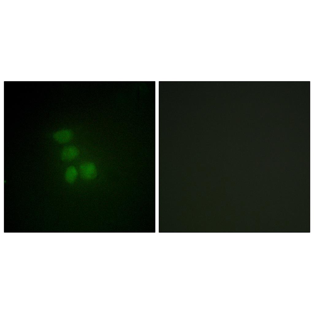 hnRNP G Rabbit Polyclonal Antibody | 兔多抗 | EnkiLife恩玑生命