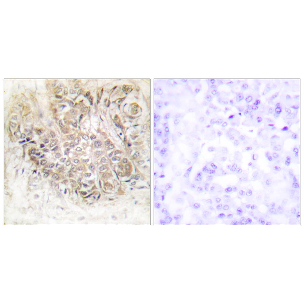 HRF Rabbit Polyclonal Antibody | 兔多抗 | EnkiLife恩玑生命