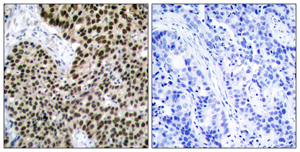HSF1 Rabbit Polyclonal Antibody | 兔多抗 | EnkiLife恩玑生命