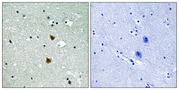 HSP27 Rabbit Polyclonal Antibody | 兔多抗 | EnkiLife恩玑生命