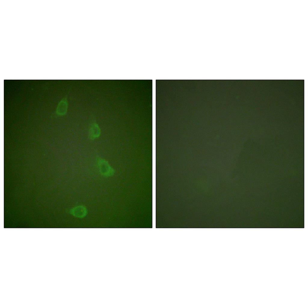 HSP40 Rabbit Polyclonal Antibody | 兔多抗 | EnkiLife恩玑生命