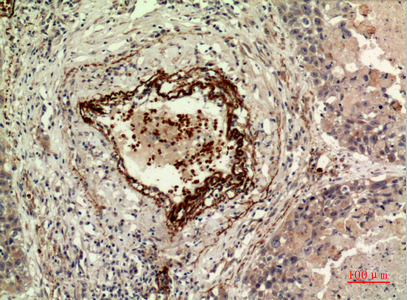 IDH1 Rabbit Polyclonal Antibody | 兔多抗 | EnkiLife恩玑生命