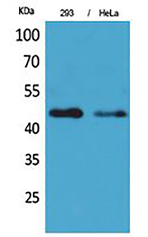 IDH1 Rabbit Polyclonal Antibody | 兔多抗 | EnkiLife恩玑生命