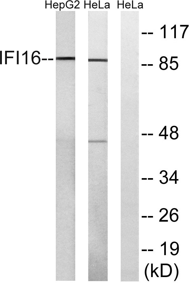IFI-16 Rabbit Polyclonal Antibody | 兔多抗 | EnkiLife恩玑生命