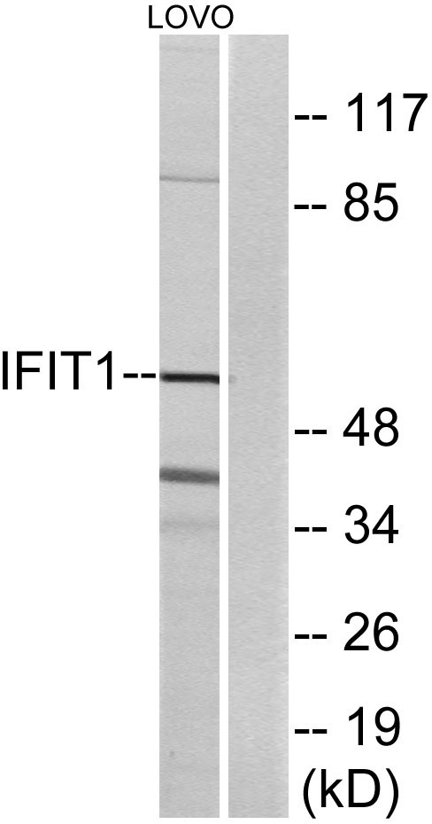 IFI-56K Rabbit Polyclonal Antibody | 兔多抗 | EnkiLife恩玑生命