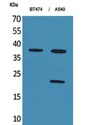 IFN-α1 Rabbit Polyclonal Antibody | 兔多抗 | EnkiLife恩玑生命
