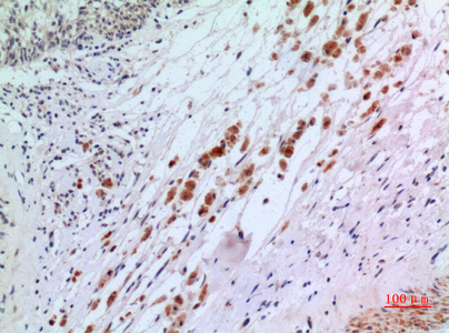 IFN-αR2 Rabbit Polyclonal Antibody | 兔多抗 | EnkiLife恩玑生命