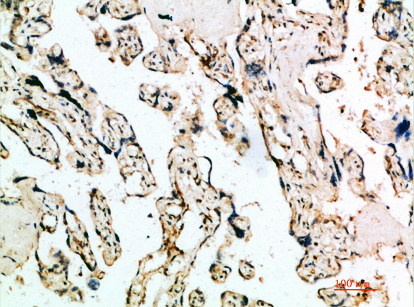 IFN-β Rabbit Polyclonal Antibody | 兔多抗 | EnkiLife恩玑生命