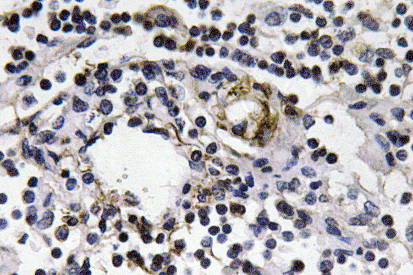 IFN-γ Rabbit Polyclonal Antibody | 兔多抗 | EnkiLife恩玑生命