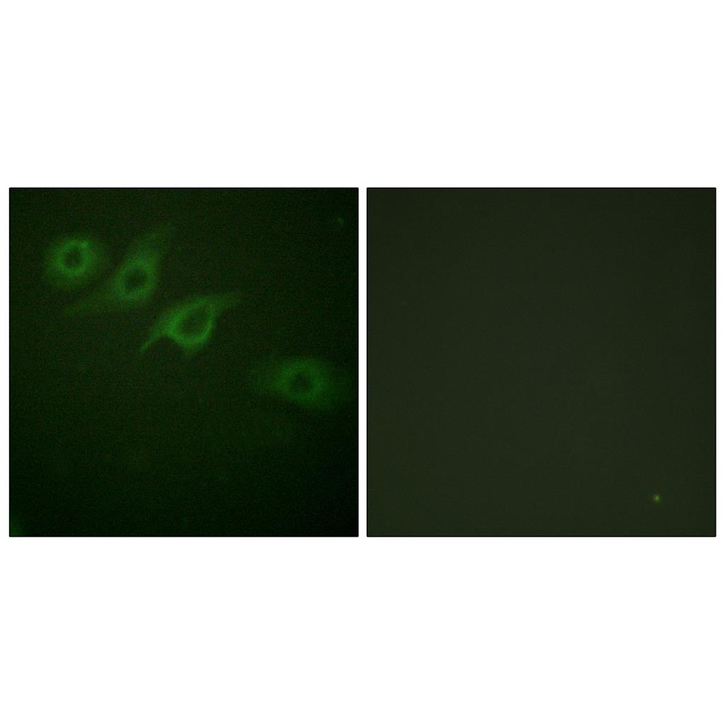 IFN-γRα Rabbit Polyclonal Antibody | 兔多抗 | EnkiLife恩玑生命