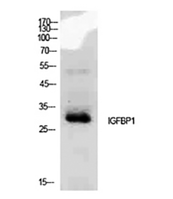 IGFBP1 Rabbit Polyclonal Antibody | 兔多抗 | EnkiLife恩玑生命
